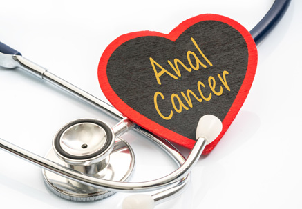 Anal Cancer Image